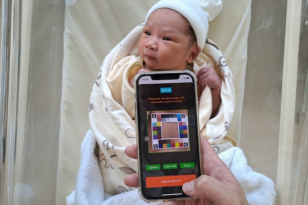 App detecting Jaundice